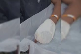 Vítima coloca mão na frente de arma e tem dedos “explodidos” por tiro