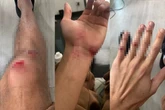 Homem espanca inquilino que descobriu “gato” em água de casa alugada