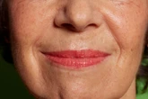 Massagem facial promete suavizar bigode chinês sem agulhas; aprenda