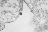 Pesquisa mostra ação do vírus oropouche em imagens de microscopia