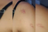 Marido é preso após agredir e deixar mulher com marcas roxas no corpo