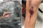Jovem é brutalmente agredida a pedradas por cunhado no Entorno do DF