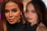 Anitta choca ao reaparecer na web com novo rosto: “Mexeu em tudo”