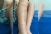 Filho de publicitário preso e agredido por agentes ficou com hematomas