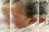 Menina de 3 anos desmaia ao ser torturada pela mãe por causa de escova