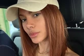 Anitta explica como procedimentos no rosto afetaram novo projeto