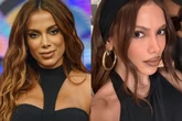 Antes e depois: veja novo rosto de Anitta em 1ª aparição após infecção