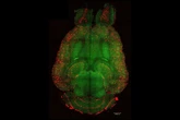 Cientistas revertem Alzheimer em camundongos usando nanopartículas