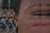 Mulher que levou 61 socos mostra rosto em recuperação: “Mão de Deus”