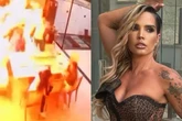 Taty Zatto fala sobre acidente doméstico grave: “Labareda de fogo”