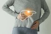 Nutricionista revela 4 chás que ajudam a desintoxicar o fígado