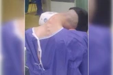 Caso raro: homem tem síndrome da “cabeça caída” causada por vício
