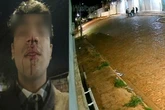 Câmera mostra artista sendo espancado após beijar rapaz em MS. Vídeo