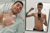 Jovem com doença no intestino vomitava todo dia: “Achei que era nada”