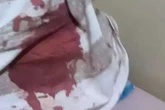 Jovem é esfaqueado pelo padrasto ao defender a mãe de agressões