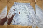 Jovem baleado no Metrô-DF: “Não teve invasão. Foi um tiro sem motivo, pelas costas”