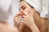 Páscoa: chocolate causa espinhas? Dermatologista explica