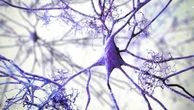 Alzheimer, l’idea: combattiamolo ripristinando il dialogo interrotto tra i neuroni