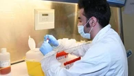 Legionella, un morto e tre ricoverati in uno stabile di alloggi popolari in via Rizzoli