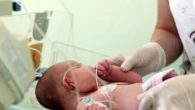 Intervento record su una bimba piuma di 750 grammi: salvata dai medici con un’operazione al cuore