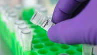 Dengue, individuati gli anticorpi dell’immunità. Saranno utili per farmaci e vaccini