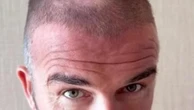 Cosa è successo ai tuoi capelli?! Victoria sgrida David. Lui: "Mi è scappata la lama"