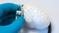 Le capacità di diagnosi neurologica dell’uomo battono quelle delle IA