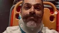 Luca Argentero con il collarino: da Doc a paziente, o si è fatto male davvero?