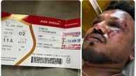 Sopravvissuto al disastro aereo in India: ecco Ramesh Viswashkumar, seduto al posto 11A