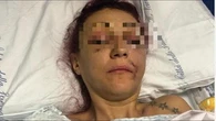 Lucia Regna, assolto l’ex compagno che la massacrò, il giudice: «Lei distrusse il matrimonio»