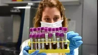 Alzheimer, la nuova mappa del rischio è nel sangue