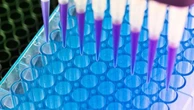 Tumore al pacreas: allo studio nuovo test per la diagnosi precoce nel sangue