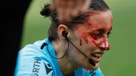 Insulti sessisti alla guardalinee spagnola ferita al volto da una telecamera: “Torna in cucina”