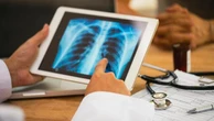 Una terapia mirata per il tumore del polmone vince il Premio Galeno 2025 per i risultati sul campo