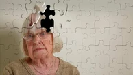 Alzheimer, per curarlo serve un mix di nuove e vecchie terapie