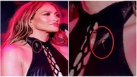 Jennifer Lopez, un grillo le salta addosso durante il concerto: lei sorride e lo trasforma in show