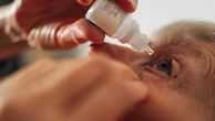 Glaucoma pseudoesfoliativo, che cos’è e come si cura la forma più aggressiva che può rubare la vista