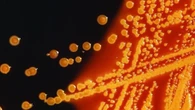 Un virus creato con l’IA: grazie a lui combatteremo i batteri resistenti agli antibiotici