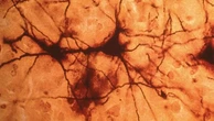 Dallo studio dei neuroni strategie per migliorare la memoria dell’intelligenza artificiale