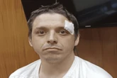 Son accused of killing father over Mexican food argument