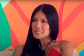 Love Island star praised for ‘inspirational’ discussion on burn scars