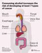 Alcohol consumption increases your risk of these 7 types of cancer