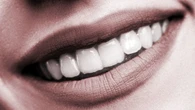 SmileDirectClub says you need to keep making payments on those dental aligners. Do you?