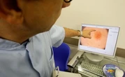 Comment se prémunir des cancers de la peau ?