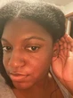 The Chronic Autoimmune Condition You’ve Never Heard Of — But I Live With Every Day