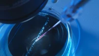 La terapia genética consigue devolver la audición a diez jóvenes inyectándoles un virus sintético en el oído