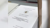 El insólito TFG de un estudiante de Medicina que está levantando pasiones por su peculiar temática: "Estoy dando volteretas"