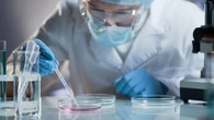 Investigadores españoles diseñan una estrategia para disminuir los niveles de colesterol en sangre