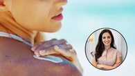 Luisa Martos, dermatóloga: "La fotoprotección solar sí es eficaz"