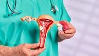 Las afectadas de cáncer de ovario reclaman una atención específica realizada por ginecólogos oncólogos